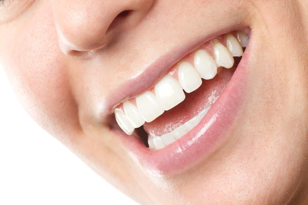 What Are the Advantages of Dental Veneers?